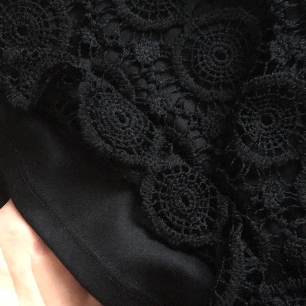 Black patterned shorts - Picture 3 of 3